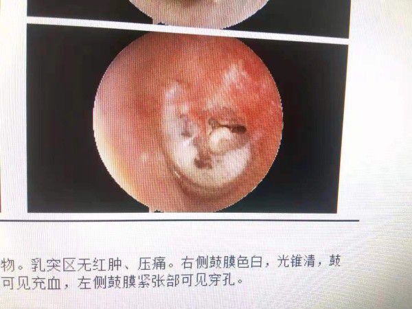 余福銀最新動態(tài)與成就概覽